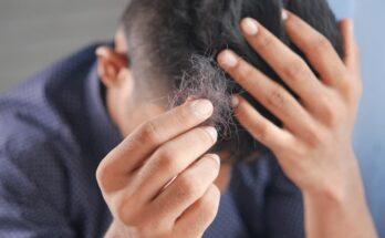 Hair Shedding vs Hair Loss